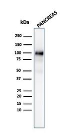 GP2 (Glycoprotein 2)/ZAP75 Antibody in Western Blot (WB)