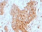 Glucose 6-Phosphate Isomerase Antibody in Immunohistochemistry (Paraffin) (IHC (P))