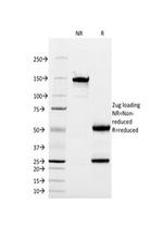 CD13/Aminopeptidase-N (Myeloid Cell Marker) Antibody in SDS-PAGE (SDS-PAGE)