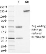 CD13/Aminopeptidase-N (Myeloid Cell Marker) Antibody in SDS-PAGE (SDS-PAGE)