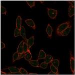 ZC3H7A (Transcription Factor) Antibody in Immunocytochemistry (ICC/IF)