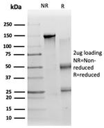 ZC3H7A (Transcription Factor) Antibody in SDS-PAGE (SDS-PAGE)