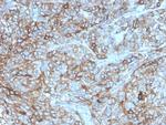 PD-L1/PDCD1LG1/CD274/B7-H1 (Cancer Immunotherapy Target) Antibody in Immunohistochemistry (Paraffin) (IHC (P))