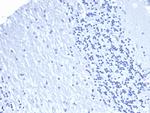 PD-L1/PDCD1LG1/CD274/B7-H1 (Cancer Immunotherapy Target) Antibody in Immunohistochemistry (Paraffin) (IHC (P))