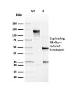 PD-L1/PDCD1LG1/CD274/B7-H1 (Cancer Immunotherapy Target) Antibody in SDS-PAGE (SDS-PAGE)