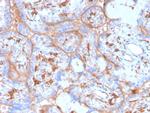 PD-L1/PDCD1LG1/CD274/B7-H1 (Cancer Immunotherapy Target) Antibody in Immunohistochemistry (Paraffin) (IHC (P))