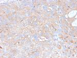 PD-L1/PDCD1LG1/CD274/B7-H1 (Cancer Immunotherapy Target) Antibody in Immunohistochemistry (Paraffin) (IHC (P))