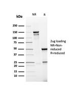 PD-L1/PDCD1LG1/CD274/B7-H1 (Cancer Immunotherapy Target) Antibody in SDS-PAGE (SDS-PAGE)