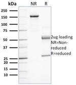 PD-L1/PDCD1LG1/CD274/B7-H1 (Cancer Immunotherapy Target) Antibody in SDS-PAGE (SDS-PAGE)