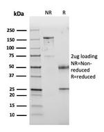 PD-L1/PDCD1LG1/CD274/B7-H1 (Cancer Immunotherapy Target) Antibody in SDS-PAGE (SDS-PAGE)