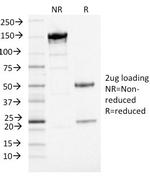 PD-L1/PDCD1LG1/CD274/B7-H1 (Cancer Immunotherapy Target) Antibody in SDS-PAGE (SDS-PAGE)