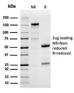 PD-L1/PDCD1LG1/CD274/B7-H1 (Cancer Immunotherapy Target) Antibody in SDS-PAGE (SDS-PAGE)