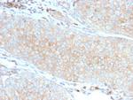 PD-L1/PDCD1LG1/CD274/B7-H1 (Cancer Immunotherapy Target) Antibody in Immunohistochemistry (Paraffin) (IHC (P))