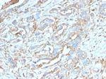 PD-L1/PDCD1LG1/CD274/B7-H1 (Cancer Immunotherapy Target) Antibody in Immunohistochemistry (Paraffin) (IHC (P))