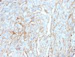 PD-L1/PDCD1LG1/CD274/B7-H1 (Cancer Immunotherapy Target) Antibody in Immunohistochemistry (Paraffin) (IHC (P))