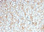 PD-L1/PDCD1LG1/CD274/B7-H1 (Cancer Immunotherapy Target) Antibody in Immunohistochemistry (Paraffin) (IHC (P))