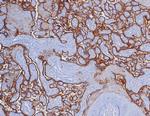 PD-L1/PDCD1LG1/CD274/B7-H1 (Cancer Immunotherapy Target) Antibody in Immunohistochemistry (Paraffin) (IHC (P))