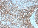 PD-L1/PDCD1LG1/CD274/B7-H1 (Cancer Immunotherapy Target) Antibody in Immunohistochemistry (Paraffin) (IHC (P))