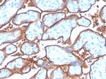 PD-L1/PDCD1LG1/CD274/B7-H1 (Cancer Immunotherapy Target) Antibody in Immunohistochemistry (Paraffin) (IHC (P))