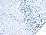 PD-L1/PDCD1LG1/CD274/B7-H1 (Cancer Immunotherapy Target) Antibody in Immunohistochemistry (Paraffin) (IHC (P))