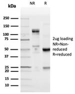 PD-L1/PDCD1LG1/CD274/B7-H1 (Cancer Immunotherapy Target) Antibody in SDS-PAGE (SDS-PAGE)