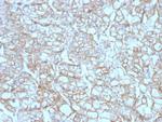 PD-L1/PDCD1LG1/CD274/B7-H1 (Cancer Immunotherapy Target) Antibody in Immunohistochemistry (Paraffin) (IHC (P))