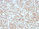 PD-L1/PDCD1LG1/CD274/B7-H1 (Cancer Immunotherapy Target) Antibody in Immunohistochemistry (Paraffin) (IHC (P))