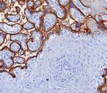 PD-L1/PDCD1LG1/CD274/B7-H1 (Cancer Immunotherapy Target) Antibody in Immunohistochemistry (Paraffin) (IHC (P))