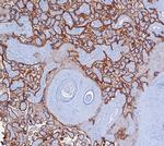 PD-L1/PDCD1LG1/CD274/B7-H1 (Cancer Immunotherapy Target) Antibody in Immunohistochemistry (Paraffin) (IHC (P))