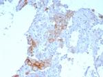 PD-L1/PDCD1LG1/CD274/B7-H1 (Cancer Immunotherapy Target) Antibody in Immunohistochemistry (Paraffin) (IHC (P))