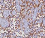 PD-L1/PDCD1LG1/CD274/B7-H1 (Cancer Immunotherapy Target) Antibody in Immunohistochemistry (Paraffin) (IHC (P))