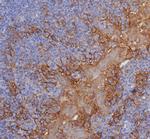 PD-L1/PDCD1LG1/CD274/B7-H1 (Cancer Immunotherapy Target) Antibody in Immunohistochemistry (Paraffin) (IHC (P))