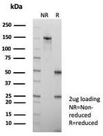 PD-L1/PDCD1LG1/CD274/B7-H1 (Cancer Immunotherapy Target) Antibody in SDS-PAGE (SDS-PAGE)