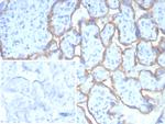 PD-L1/PDCD1LG1/CD274/B7-H1 (Cancer Immunotherapy Target) Antibody in Immunohistochemistry (Paraffin) (IHC (P))