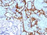 PD-L1/PDCD1LG1/CD274/B7-H1 (Cancer Immunotherapy Target) Antibody in Immunohistochemistry (Paraffin) (IHC (P))