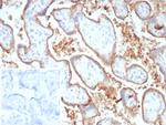 PD-L1/PDCD1LG1/CD274/B7-H1 (Cancer Immunotherapy Target) Antibody in Immunohistochemistry (Paraffin) (IHC (P))