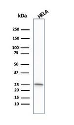 Glutathione S-Transferase Mu1 (GSTM1) Antibody in Western Blot (WB)