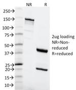 MSH6 (DNA Mismatch Repair Protein) Antibody in SDS-PAGE (SDS-PAGE)