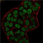 MSH6 (DNA Mismatch Repair Protein) Antibody in Immunocytochemistry (ICC/IF)