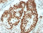 MSH6 (DNA Mismatch Repair Protein) Antibody in Immunohistochemistry (Paraffin) (IHC (P))