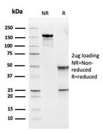 MSH6 (DNA Mismatch Repair Protein) Antibody in SDS-PAGE (SDS-PAGE)