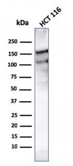 MSH6 (DNA Mismatch Repair Protein) Antibody in Western Blot (WB)