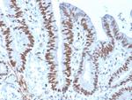 MSH6 (DNA Mismatch Repair Protein) Antibody in Immunohistochemistry (Paraffin) (IHC (P))