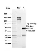 MSH6 (DNA Mismatch Repair Protein) Antibody in SDS-PAGE (SDS-PAGE)