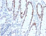 MSH6 (DNA Mismatch Repair Protein) Antibody in Immunohistochemistry (Paraffin) (IHC (P))