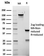 MSH6 (DNA Mismatch Repair Protein) Antibody in SDS-PAGE (SDS-PAGE)