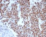 MSH6 (DNA Mismatch Repair Protein) Antibody in Immunohistochemistry (Paraffin) (IHC (P))