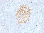 MSH6 (DNA Mismatch Repair Protein) Antibody in Immunohistochemistry (Paraffin) (IHC (P))