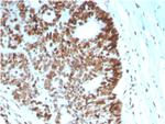 MSH6 (DNA Mismatch Repair Protein) Antibody in Immunohistochemistry (Paraffin) (IHC (P))