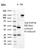 MSH6 (DNA Mismatch Repair Protein) Antibody in SDS-PAGE (SDS-PAGE)